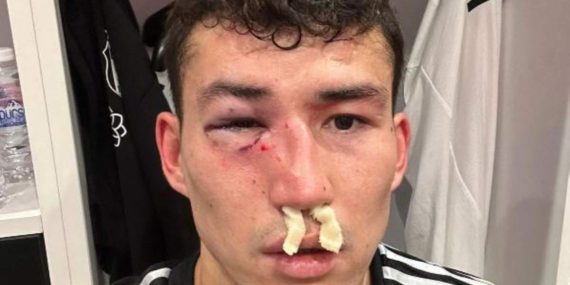 Zaynutdinov hastaneye kaldırıldı