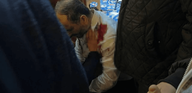 fatih-camii-imami-camide-bicakli-saldiriya-ugradi-H1513795-11-661