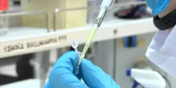 SMA’da ilaç tedavisi için kök hücre testi! İlaçların ne kadar fayda sağladığı öngörülebilecek