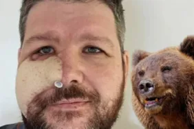 Avlanırken ayı saldırısına uğradı! Yüzü parçalanan adamın arkadaşlarından ilginç intikam