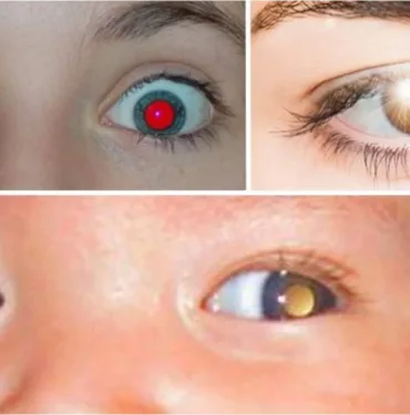 Fotoğraflarda gözlerinizin kırmızı çıkmasının sebebi...