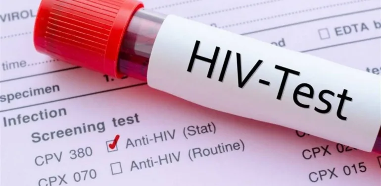 HIV Türkiye'de artıyor... Çoğu vaka tesadüfen bulunuyor!