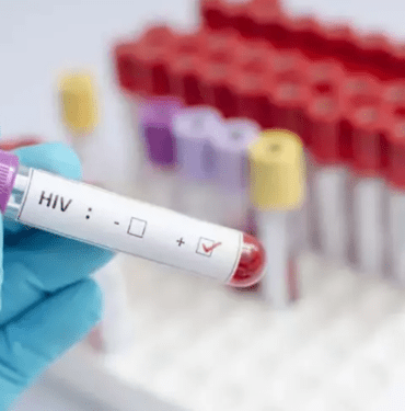 Uzmanı uyard HIV virüsü kanser dahil pek çok hastalığa yol açabilir