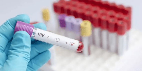Uzmanı uyardı: HIV virüsü kanser dahil pek çok hastalığa yol açabilir