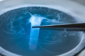 dondurulmuş embriyo