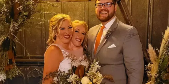 ABD’li yapışık ikizlerden Abby evlendi