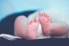 Bebeğin kafatasından ikizi çıkarıldı