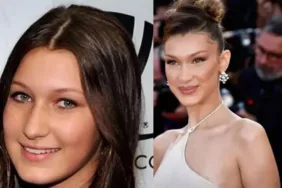 Bella Hadid'in estetik itirafları güzelliğin ardındaki hikaye