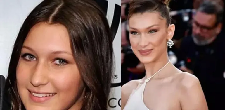 Bella Hadid'in estetik itirafları güzelliğin ardındaki hikaye
