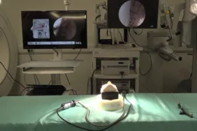 Beyin cerrahisinde yapay zeka devri!