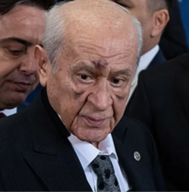 Devlet Bahçeli'nin yüzündeki morluklar için partiden açıklama geldi