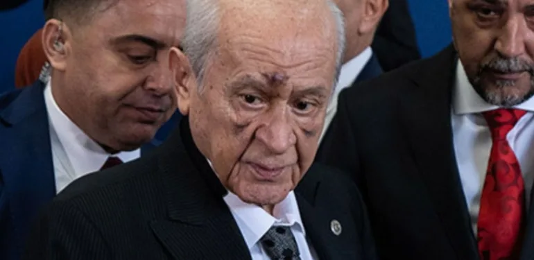 Devlet Bahçeli'nin yüzündeki morluklar için partiden açıklama geldi