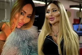 Dünyanın en büyük elmacık kemiklerine sahip... Anastasia Pokreshchuk estetiklerini sıraladı