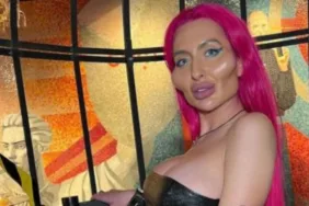 Sosyal medyanın 'En Büyük Yanaklı' fenomeni Anastasia Pokreshchuk'un çarpıcı değişimi