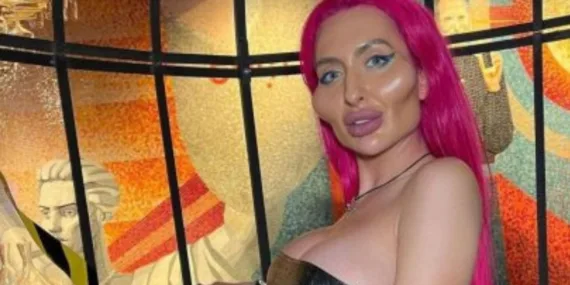 Sosyal medyanın ‘En Büyük Yanaklı’ fenomeni: Anastasia Pokreshchuk’un çarpıcı değişimi