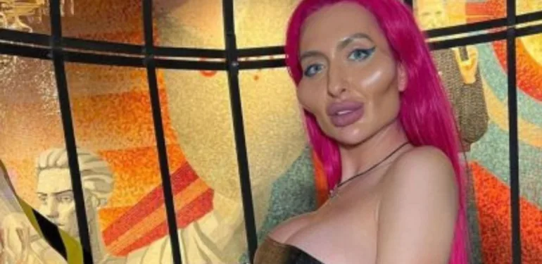Sosyal medyanın 'En Büyük Yanaklı' fenomeni Anastasia Pokreshchuk'un çarpıcı değişimi