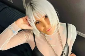 Yonca Evcimik yüzündeki değişimle gündem oldu!