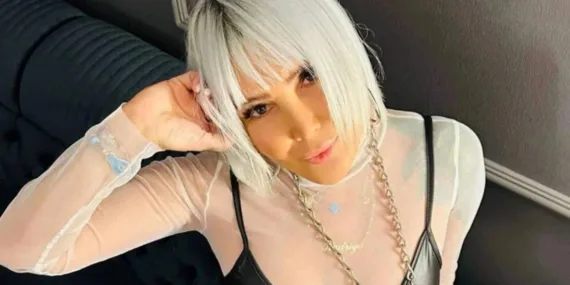 Yonca Evcimik yüzündeki değişimle gündem oldu!