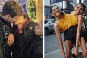 23 yaşındaki yapışık ikizler merak edilen sorulara cevap verdi