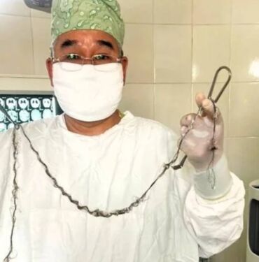 Ameliyatla beyinden çıkarıldı Metrelerce uzunluğunda