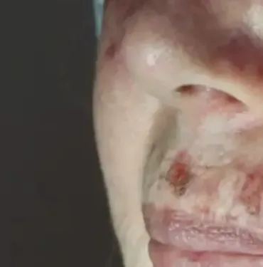Dermatoloji Uzmanı uyardı! Makyaj yaparken bunlara dikkat edin