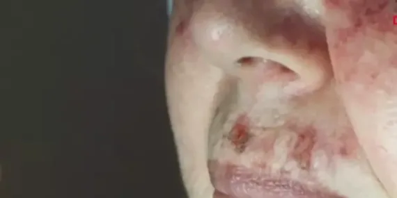 Dermatoloji Uzmanı uyardı! Makyaj yaparken bunlara dikkat edin