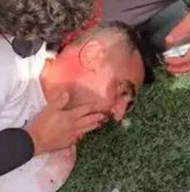 Kavgada antrenörün yüzüne tekme attı dil boğazına kaçtı!