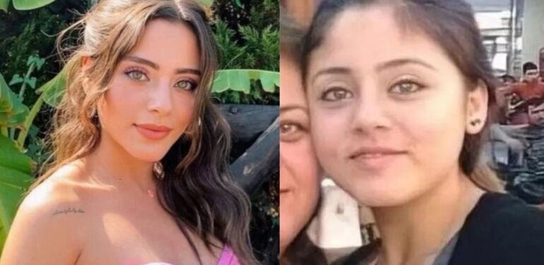Sıla Türkoğlu’ndan estetik iddialarına sert yanıt