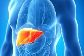 Çağımızın hastalığı Karaciğer yağlanması