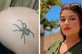 Tek ısırık hamile kadının hayatını mahvetti