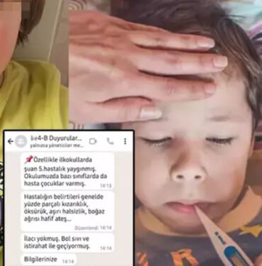 Uzmanlar uyardı! Baharın çocuklara sürprizi Beşinci hastalık