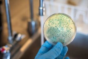 Japonya'da 'et yiyen' STSS bakterisi vaka sayısı en yüksek seviyesinde