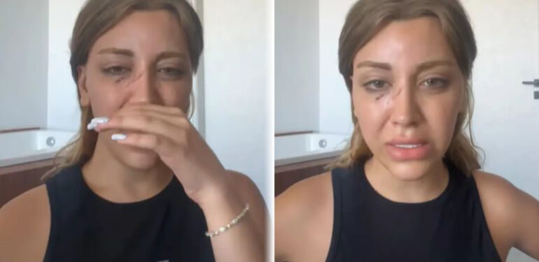 Mika Raun gözyaşlarını tutamadı! Yaşadığı saldırının sebebini açıkladı