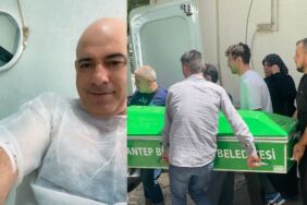 Saç ekimi için girdiği hastanede öldü Ailesi şikayetçi oldu