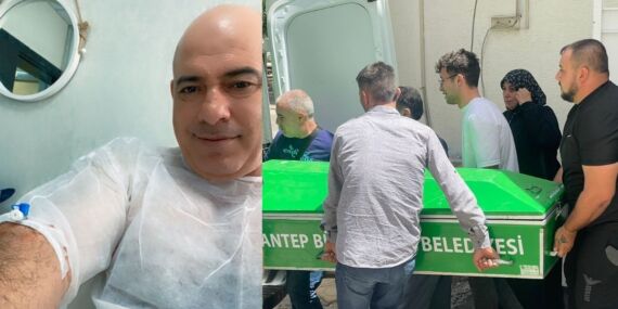 Saç ekimi için girdiği hastanede öldü: Ailesi şikayetçi oldu