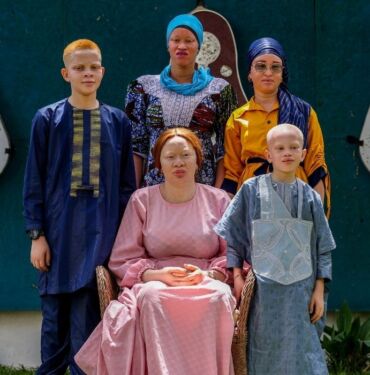 Toplumsal ayrımcılıkla mücadele eden Afrikalı albinolar