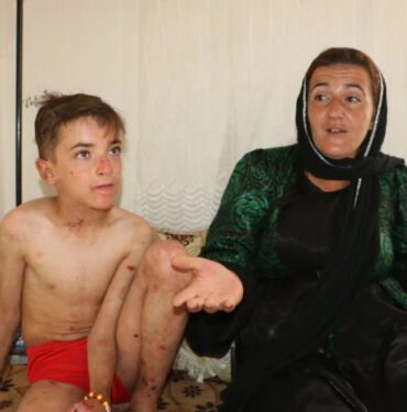 10 yaşındaki Amar Yaşar 'deri hastalığından' kurtulmak istiyor 'Vücudum yaralardan sürekli kanıyor'