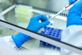 Her yıl 1,4 milyon kişi 'hepatit' kurbanı! Hepatitten nasıl korunuruz