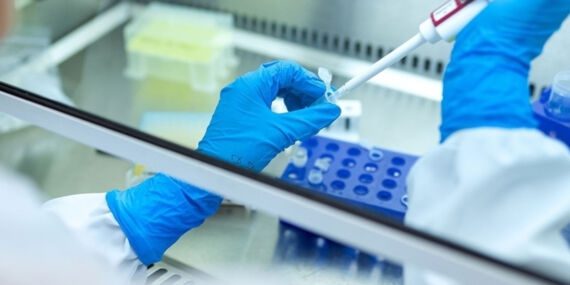 Her yıl 1,4 milyon kişi ‘hepatit’ kurbanı! Hepatitten nasıl korunuruz?