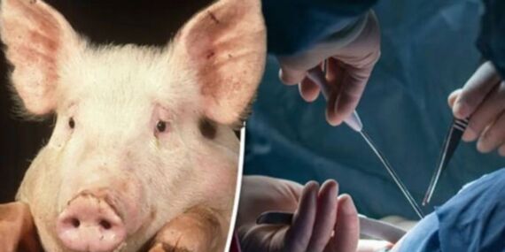 Xenotransplantasyon başarısı: Domuz böbreği Amerikalı hastaya umut oldu