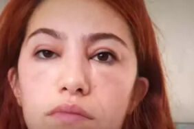 rimel kullanan kadının hayatı felakete dönüştü