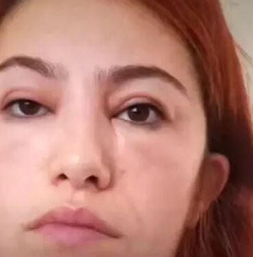 rimel kullanan kadının hayatı felakete dönüştü