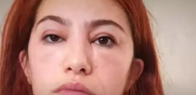 rimel kullanan kadının hayatı felakete dönüştü
