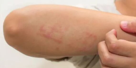 Alışveriş keyfiniz kabusa dönmesin: Yıkanmadan giyilen kıyafetlerdeki tehlikeye dikkat!