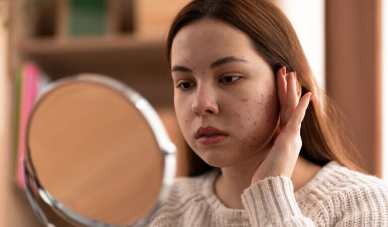 Dikkat! Bu belirtiler çinko eksikliği habercisi olabilir