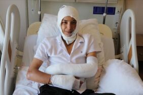 Elinde patlayan elektronik sigara, yüzünü ve vücudunu yaktı