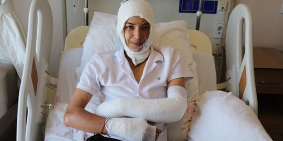 Elinde patlayan elektronik sigara, yüzünü ve vücudunu yaktı