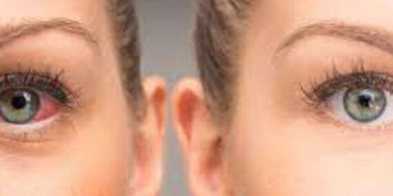 Görme yetinizi keskinleştirin : Göz sağlığını destekleyen 8 mucizevi besin