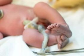 Otizmin nedeni bulundu_ Hastalığın önüne geçilebilir