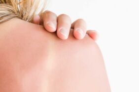 TikTok'un yeni trendi 'güneş yanığı' kanser riskini artırabilir